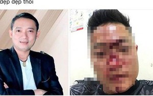Vụ khán giả bị đánh "nát mặt", Chiến Thắng: Chương trình dừng lại, tôi phải về ngay trong đêm!