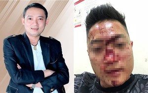 Lo lắng Chiến Thắng bị sàm sỡ, các vệ sĩ đánh "nát mặt" khán giả?