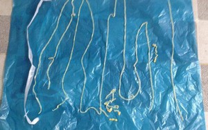 Ớn lạnh với ổ sán lợn tại Bình Phước: 55 tỉnh, thành có người mắc bệnh