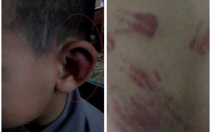 TT Thích Đức Thiện: Không thể chấp nhận việc nhà sư dùng đòn roi bạo hành trẻ mồ côi