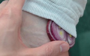 Đặt hành tây vào tất chân khi đi ngủ: Đừng buồn cười khi chưa kiểm chứng hiệu quả kỳ diệu