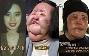 "Thảm hoạ dao kéo" Han Mi Ok qua đời ở tuổi 57: Tuổi trẻ điên cuồng thẩm mỹ, mua silicon, dầu ăn ở chợ đen về tự tiêm