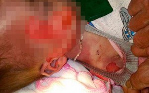 Vụ bé 15 tháng tuổi tử vong với nhiều vết thương "lạ": BV khẳng định không làm rơi bệnh nhi