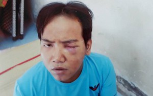 Bảo vệ dân phố sát hại bé trai 6 tuổi bị tâm thần phân liệt