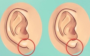 Nhìn tai bắt bệnh: Những dấu hiệu nguy hiểm bạn không ngờ