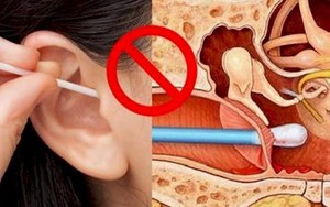 [Video] Trước khi sử dụng tăm bông ngoáy tai, hãy xem ngay để biết tác hại thế nào