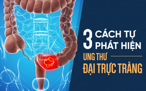 Cách tự kiểm tra ung thư đại trực tràng: Phát hiện sớm 3 tháng, có thể sống thêm 30 năm