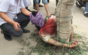 Lao đầu vào ô tô tự tử bất thành, nam thanh niên bị trói vào gốc cây