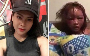 Thái Lan: Cô gái bị bạn trai cuồng ghen livetream cảnh đánh đập, đốt tóc đến biến dạng mặt