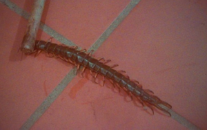 Ngủ trưa dưới sàn nhà, bé gái 6 tuổi bị con rết chui vào tai