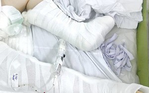 Rơi từ lầu 3, bé gái ở Sài Gòn thoát chết