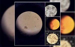 Loạt ảnh "mặt Trăng" được chia sẻ nhiều trên MXH thực chất là... phân dưới kính hiển vi
