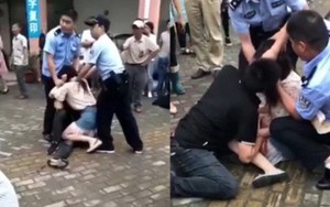“Hôn lần cuối”, cô gái cắn gần đứt lưỡi bạn trai