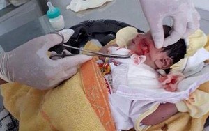 Bình Thuận: Cứu sống bé sơ sinh 1 ngày tuổi bị chôn dưới đất