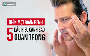 5 thay đổi trên mặt là dấu hiệu cảnh báo bệnh nguy hiểm đang phát triển: Hãy đề phòng sớm!