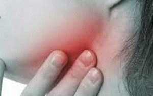 Ung thư họng và những dấu hiệu không nên bỏ qua