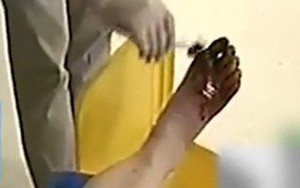 Con gái hiếu thảo thấy mẹ bị nấm liền mua thuốc khử trùng để ngâm chân, 3 ngày sau bà nhập viện vì suýt hoại tử