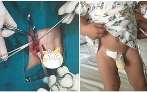 Thấy con có khối u nhỏ ở háng nhưng mẹ không bận tâm, đưa con đi khám nghe bác sĩ nói mẹ mới hốt hoảng