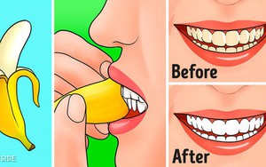 Ăn chuối hàng ngày nhưng ít người biết 7 công dụng từ vỏ chuối: Nhớ đừng vứt vào thùng rác