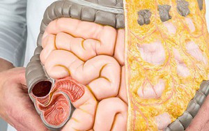 Nhà khoa học Mỹ giải thích đốt cháy chất béo là gì, và tại sao gọi là "đốt"?