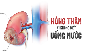 4 kiểu uống nước làm tổn thương thận: Đáng tiếc có thể bạn cũng mắc sai lầm này