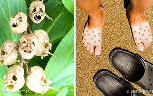 Những khoảnh khắc trùng hợp hiếm gặp với tỷ lệ một phần triệu