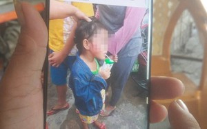 Xác định giáo viên đánh bé gái 5 tuổi nứt xương hàm trong trường mẫu giáo ở Sài Gòn