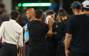Rooney đổ máu, khâu 5 mũi trong ngày ghi bàn đầu cho CLB Mỹ