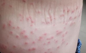 Nghi vấn nước biển Đà Nẵng gây ngứa cho người dân và du khách