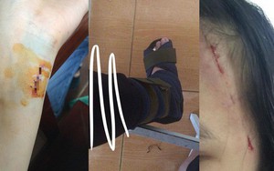 Chuyện đời "thánh tai nạn": Vấp áo dài ngã gãy chân, ốm nặng do... hóc sữa và hàng loạt biến cố khác chẳng giống ai