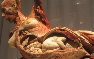 Triển lãm cơ thể người, thai nhi ở TP.HCM làm "nóng" họp báo Bộ Văn hóa