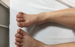 Cảnh giác với bệnh nhà giàu