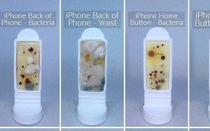 Hình ảnh kinh hoàng về độ bẩn của những chiếc điện thoại: Nhiều vi khuẩn gấp 10 lần bồn cầu