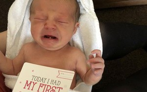 "Bệnh lạ" khiến bé gái 12 ngày tuổi phải… đi nhổ răng