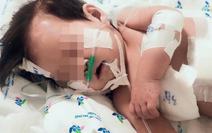 Cứu sống trường hợp bệnh nhi nhiễm cùng lúc 2 siêu vi khuẩn đa kháng