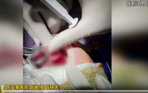Góc cảnh báo: Cho con nhỏ chơi đùa ở ghế sau ô tô, mẹ bất ngờ đánh lái rẽ khiến con ngã đứt lưỡi