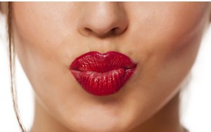 Thẩm mỹ bơm môi: Đẹp xinh hay thảm họa?