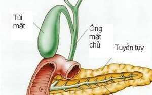 Từ trường hợp tử vong do viêm tụy cấp: Căn bệnh này nguy hiểm thế nào?