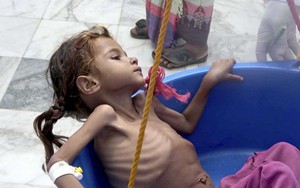 Người dân Yemen phải ăn lá cây vì đói do chiến tranh