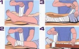 Xử trí khi bị rắn độc cắn