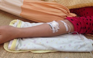 Tự ý truyền dịch tại nhà, một phụ nữ nguy kịch tính mạng