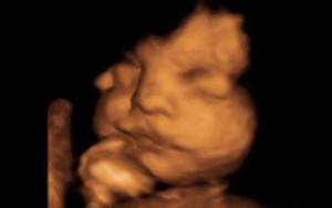 Khoảnh khắc siêu đáng yêu: Em bé quay mặt, vẫy tay chào khi còn trong bụng mẹ