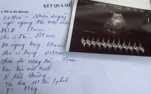 Bác sĩ ở Hải Phòng bị tố tắc trách khiến thai nhi chết lưu