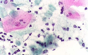 Nấm Candida sinh dục