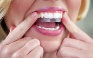 Có nên làm trắng răng "thần tốc" bằng miếng dán?