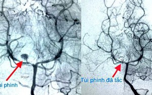 Căn bệnh hiếm gặp cực nguy hiểm ở trẻ nhưng không dễ phát hiện