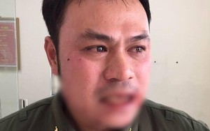 Nhân viên an ninh sân bay Nội Bài bị "cò" taxi đánh gãy răng