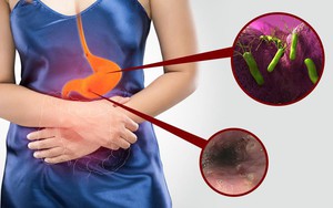 Viêm loét dạ dày tá tràng: Nguyên nhân, triệu chứng và cách điều trị bệnh