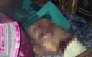 Điện Biên: Chồng say rượu tẩm xăng đốt vợ tử vong