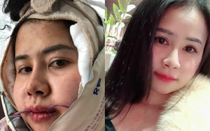 Từng bị chồng bỏ vì xấu, mọi người chế nhạo, 6 năm sau 9x đã có màn tái xuất ngoạn mục
